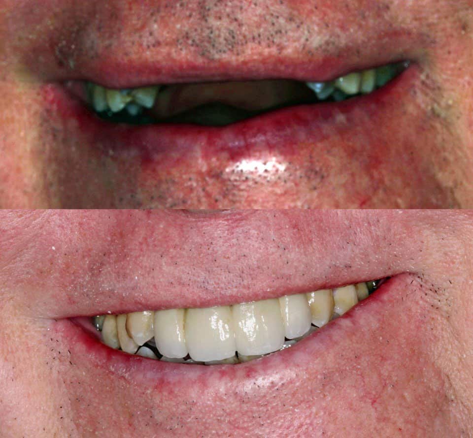 dental before and after