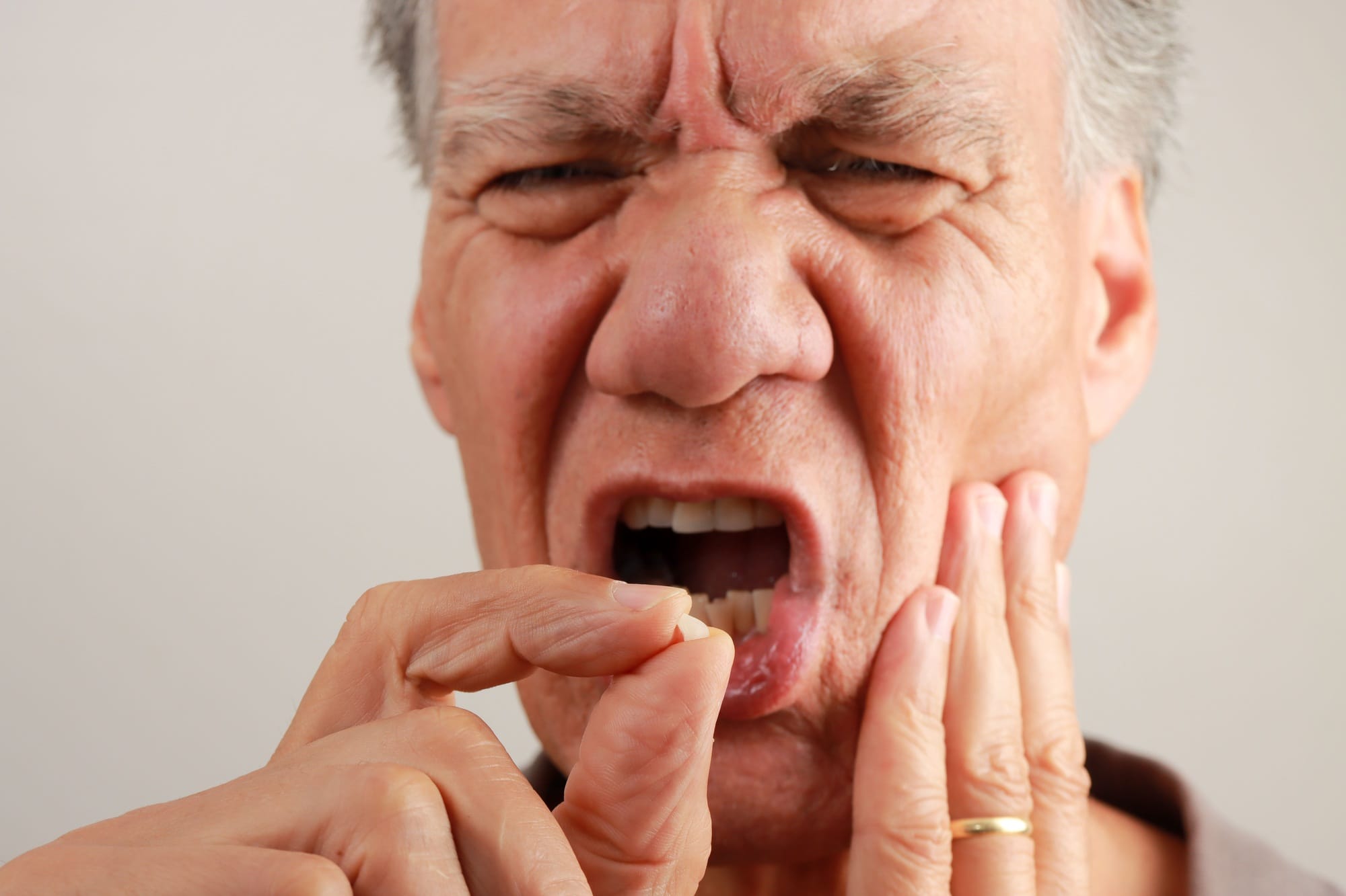 Mature man holding a broken tooth in pain, showing dental issues and discomfort